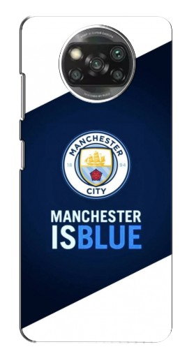 Чехол с принтом «Manchester is Blue» для Xiaomi Poco X3