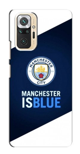 Чехол с картинкой «Manchester is Blue» для Xiaomi Redmi Note 10