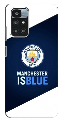 Силиконовый чехол с изображением «Manchester is Blue» для Xiaomi Redmi 10