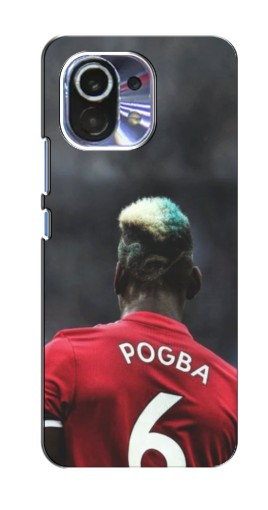 Чехол с картинкой «Pogba 6» для Xiaomi Mi 11