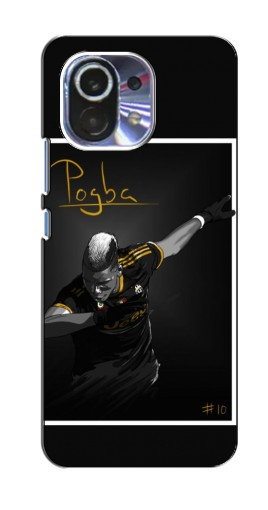 Чехол с печатью «Pogba Uve»  для Xiaomi Mi 11