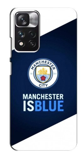 Силиконовый чехол с изображением «Manchester is Blue» для Xiaomi Redmi Note 11