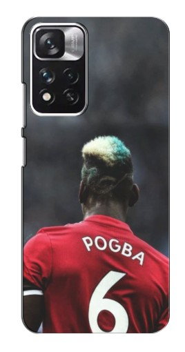 Чехол с картинкой «Pogba 6» для Xiaomi Redmi Note 11