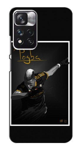 Чехол с принтом «Pogba Uve» для Xiaomi Redmi Note 11