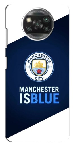 Чехол с принтом "Manchester is Blue" для Oppo Reno 4