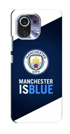 Чехол с принтом «Manchester is Blue» для Xiaomi Mi 11 Lite