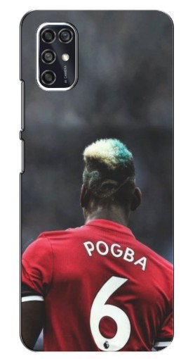 Чехол с печатью «Pogba 6»  для ZTE Blade V2020 Smart