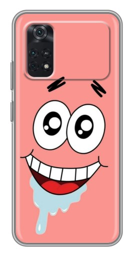 Силиконовый чехол с изображением "Патрик" для Xiaomi POCO M4 Pro 4G