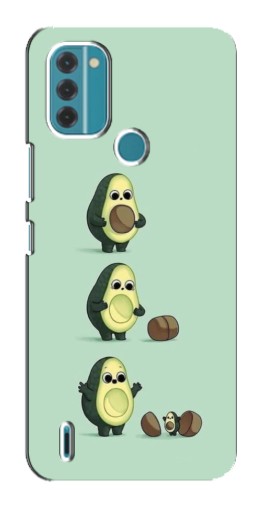 Чехол с печатью "Рождение авокадо" для Nokia C31