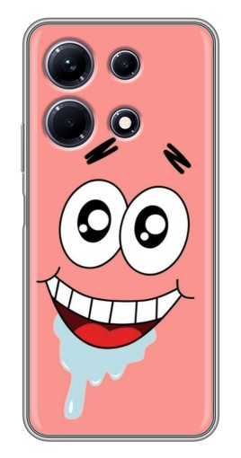 Силиконовый чехол с изображением "Патрик" для Infinix Note 30
