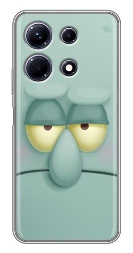 Силиконовый чехол с изображением "Сквидвард" для Infinix Note 30