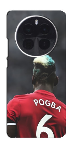 Чехол с картинкой "Pogba 6" для Realme GT5 Pro