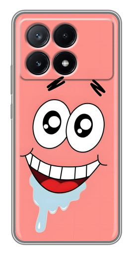 Чехол с картинкой "Патрик" для Xiaomi POCO X6 Pro (5G)