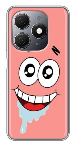 Чехол с печатью "Патрик" для TECNO Spark 20