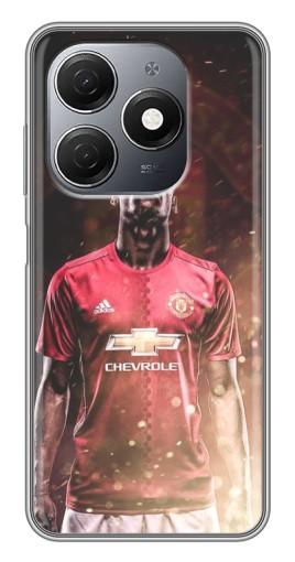 Чехол с картинкой "Погба" для TECNO Spark 20