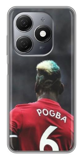 Чехол с картинкой "Pogba 6" для TECNO Spark 20