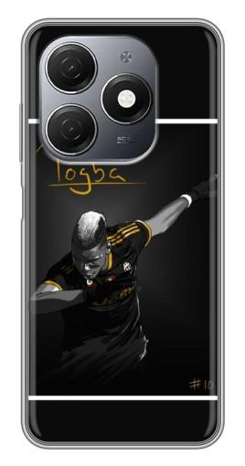 Чехол с картинкой "Pogba Uve" для TECNO Spark 20