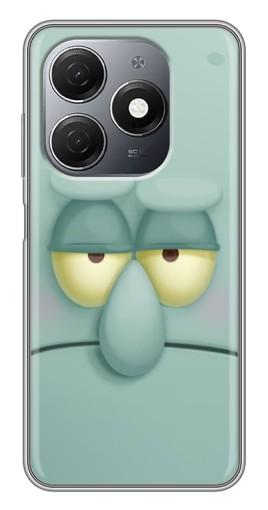 Чехол с печатью "Сквидвард" для TECNO Spark 20