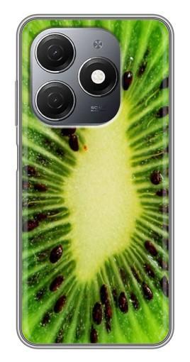Чехол с печатью "Яркий Киви" для TECNO Spark 20