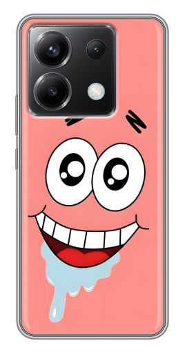 Чехол с принтом "Патрик" для Xiaomi POCO X6 5G
