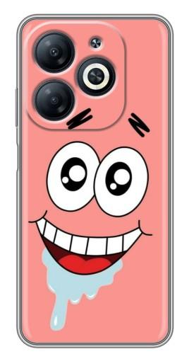 Чехол с печатью "Патрик" для Infinix Smart 8