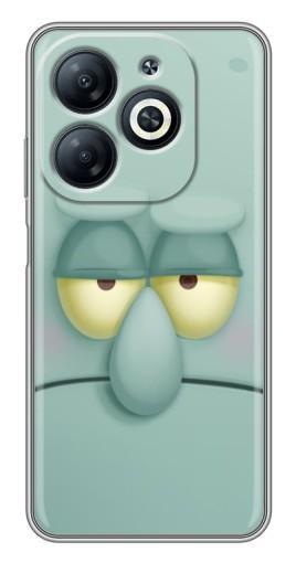Чехол с картинкой "Сквидвард" для Infinix Smart 8