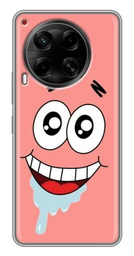 Чехол с картинкой "Патрик" для Tecno Camon 30 (CL6)