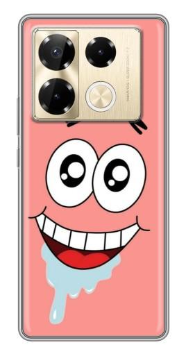 Чехол с печатью "Патрик" для Infinix Note 40 Pro