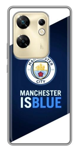 Чехол с картинкой "Manchester is Blue" для Infinix Zero 30