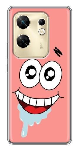 Чехол с печатью "Патрик" для Infinix Zero 30