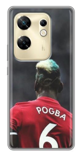 Чехол с печатью "Pogba 6" для Infinix Zero 30
