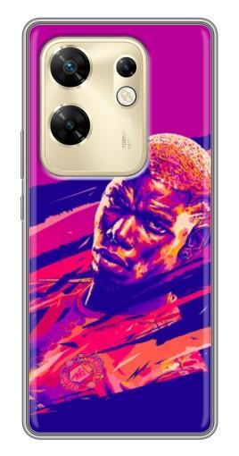 Чехол с картинкой "Погба МЮ" для Infinix Zero 30