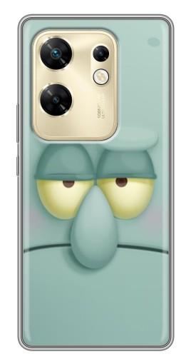 Чехол с принтом "Сквидвард" для Infinix Zero 30