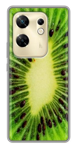 Силиконовый чехол с изображением "Яркий Киви" для Infinix Zero 30