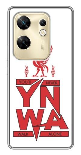 Чехол с принтом "YNWA" для Infinix Zero 30