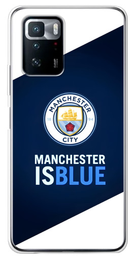Чехол с принтом "Manchester is Blue" для Xiaomi POCO X3 GT