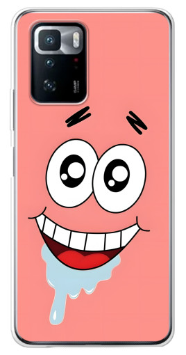 Чехол с картинкой "Патрик" для Xiaomi POCO X3 GT