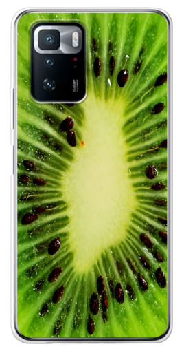 Чехол с картинкой "Яркий Киви" для Xiaomi POCO X3 GT