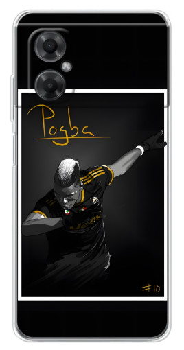 Чехол с принтом "Pogba Uve" для Xiaomi Redmi Note 11R