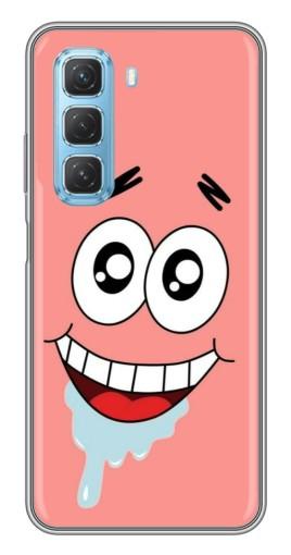 Чехол с картинкой "Патрик" для Infinix Hot 50 5G
