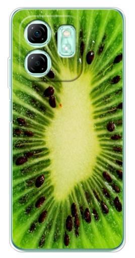 Чехол с картинкой "Яркий Киви" для Infinix Smart 9
