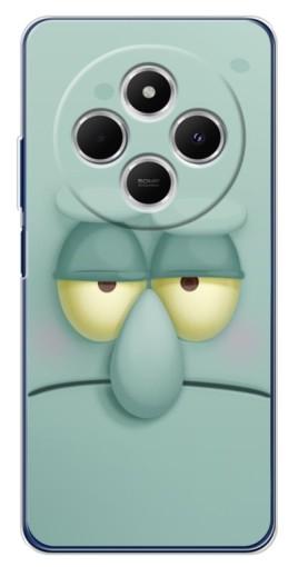 Чехол с принтом "Сквидвард" для Tecno Spark 30 Чехол с принтом "Сквидвард" для Tecno Spark 30