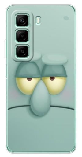 Чехол с картинкой "Сквидвард" для Infinix Hot 50i