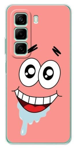 Чехол с принтом "Патрик" для Infinix Hot 50 Pro