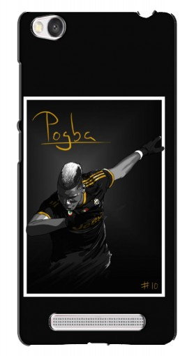 Чехол с принтом «Pogba Uve» для Xiaomi Redmi 4A