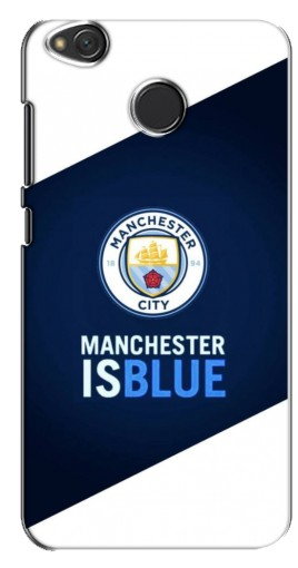 Чехол с картинкой «Manchester is Blue» для Xiaomi Redmi 4X