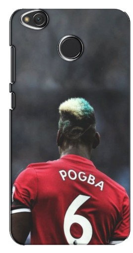 Чехол с печатью «Pogba 6»  для Xiaomi Redmi 4X