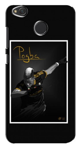 Чехол с печатью «Pogba Uve»  для Xiaomi Redmi 4X