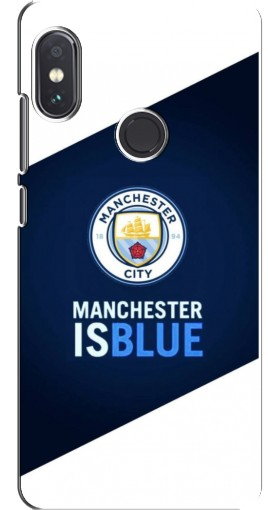 Чехол с принтом «Manchester is Blue» для Xiaomi Redmi Note 5