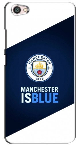 Силиконовый чехол с изображением «Manchester is Blue» для Xiaomi Redmi Note 5A